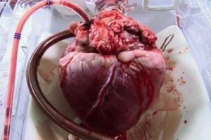 corazon2